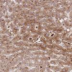 TTPAL Antibody in Immunohistochemistry (Paraffin) (IHC (P))