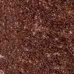 TTPAL Polyclonal Antibody