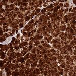 TTPAL Antibody in Immunohistochemistry (Paraffin) (IHC (P))