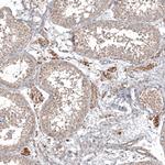 HAP40 Antibody in Immunohistochemistry (Paraffin) (IHC (P))