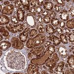 ATP5S Polyclonal Antibody