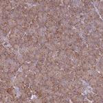 OR10Q1 Polyclonal Antibody