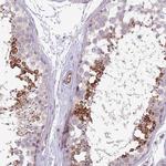 NBPF3 Polyclonal Antibody