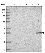 NBPF3 Antibody in Western Blot (WB)