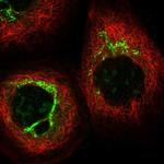 SNAPAP Polyclonal Antibody