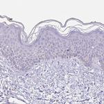 SLC44A4 Antibody in Immunohistochemistry (Paraffin) (IHC (P))