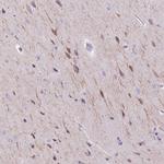 BRUNOL6 Antibody in Immunohistochemistry (Paraffin) (IHC (P))