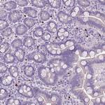 BRUNOL6 Antibody in Immunohistochemistry (Paraffin) (IHC (P))