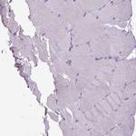 BRUNOL6 Antibody in Immunohistochemistry (Paraffin) (IHC (P))