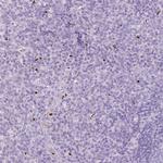 BRUNOL6 Antibody in Immunohistochemistry (Paraffin) (IHC (P))
