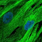 SLC16A4 Polyclonal Antibody