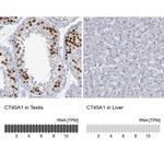 CT45A Antibody in Immunohistochemistry (Paraffin) (IHC (P))