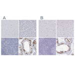 CT45A Antibody in Immunohistochemistry (Paraffin) (IHC (P))