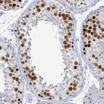 CT45A Antibody in Immunohistochemistry (Paraffin) (IHC (P))