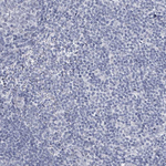 CT45A Antibody in Immunohistochemistry (Paraffin) (IHC (P))