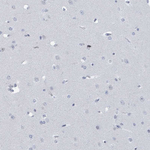 CT45A Antibody in Immunohistochemistry (Paraffin) (IHC (P))