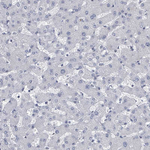 CT45A Antibody in Immunohistochemistry (Paraffin) (IHC (P))