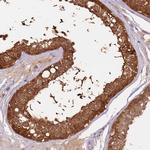 ARHGAP5 Polyclonal Antibody