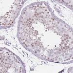 REXO4 Antibody in Immunohistochemistry (Paraffin) (IHC (P))