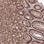 NHEDC2 Polyclonal Antibody