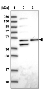 Arp3 Antibody in Western Blot (WB)