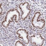 POU6F1 Antibody in Immunohistochemistry (IHC)