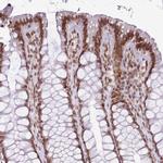 POU6F1 Antibody in Immunohistochemistry (IHC)