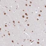 POU6F1 Antibody in Immunohistochemistry (IHC)