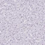 POU6F1 Antibody in Immunohistochemistry (IHC)