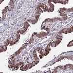 C19orf24 Antibody in Immunohistochemistry (Paraffin) (IHC (P))