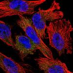 NUDT10 Polyclonal Antibody