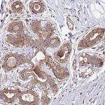 ARFRP1 Polyclonal Antibody