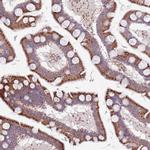 TYW1 Polyclonal Antibody