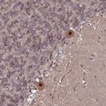 TRMT6 Antibody in Immunohistochemistry (Paraffin) (IHC (P))