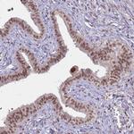 TRMT6 Antibody in Immunohistochemistry (Paraffin) (IHC (P))