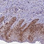 TRMT6 Antibody in Immunohistochemistry (Paraffin) (IHC (P))