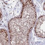TRMT6 Antibody in Immunohistochemistry (Paraffin) (IHC (P))