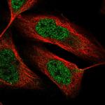 TENM3 Polyclonal Antibody