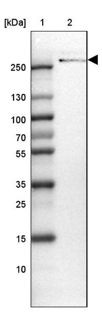 TENM3 Antibody in Western Blot (WB)