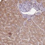 ARL10 Polyclonal Antibody