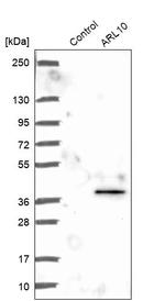 ARL10 Antibody in Western Blot (WB)