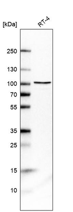 DHX15 Antibody in Western Blot (WB)