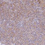 TYW1B Polyclonal Antibody