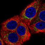 MRPL22 Polyclonal Antibody