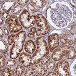 MRPL22 Antibody in Immunohistochemistry (Paraffin) (IHC (P))