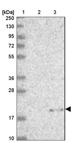 MRPL22 Antibody in Western Blot (WB)