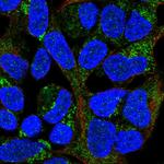 MRPL20 Polyclonal Antibody