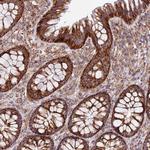 MRPL20 Antibody in Immunohistochemistry (Paraffin) (IHC (P))