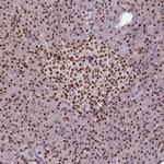 ESF1 Polyclonal Antibody