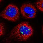 DDX27 Polyclonal Antibody